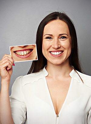 The Psychological Impact of Yellow Teeth and How to Boost Confidence